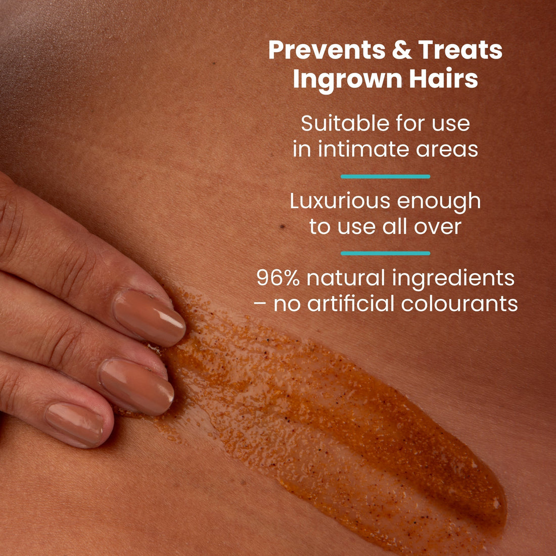 Ingrown Hair Causes, Treatment and Prevention